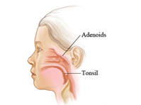 Tonsils and adenoids